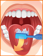 Imagem: Ilustração. Boca aberta de pessoa com a língua para frente, com escova de dente com seta para frente.  Fim da imagem.