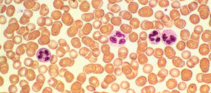 Imagem: Fotografia microscópica. Inúmeras esferas aglomeradas de cor marrom-claro, com três esferas rosas com esferas menores dentro de cor roxa.  Fim da imagem.